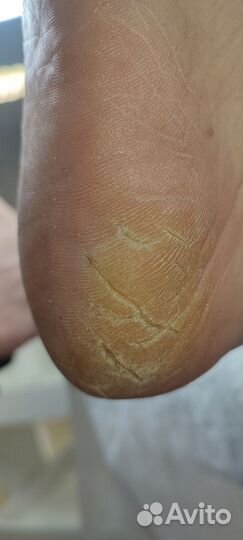 Комбинированный маникюр