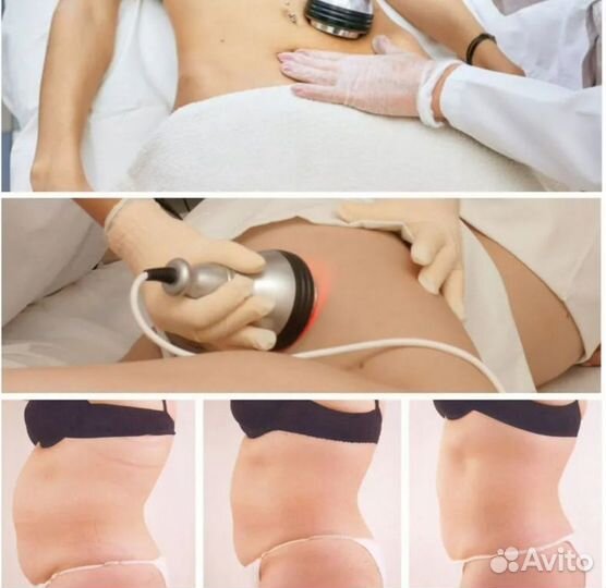 Модель на аппаратный массаж, коррекция фигуры