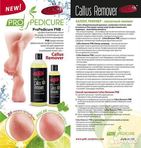 Кислотный пиллинг для педикюра Pnb, 165 мл
