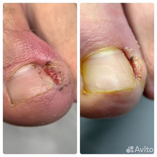 Мастер педикюра подолог