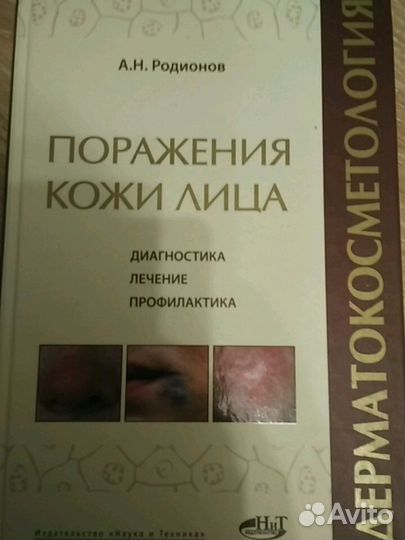 Дерматокосметология. Поражение кожи лица