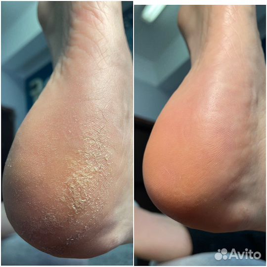 Маникюр/педикюр