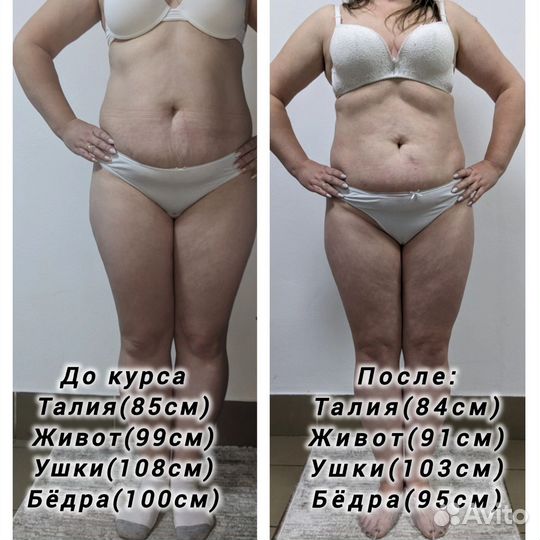 Антицеллюлитный массаж