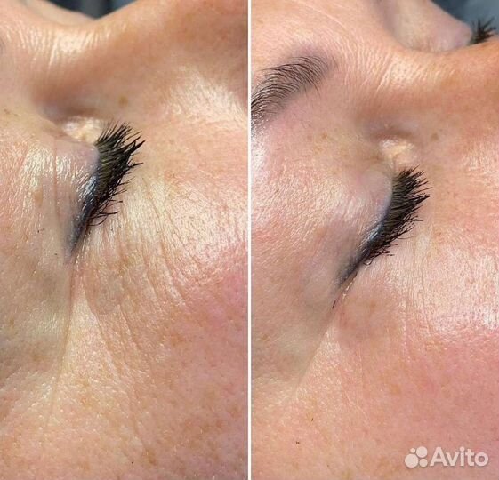 Пилинг LET для глаз и губ