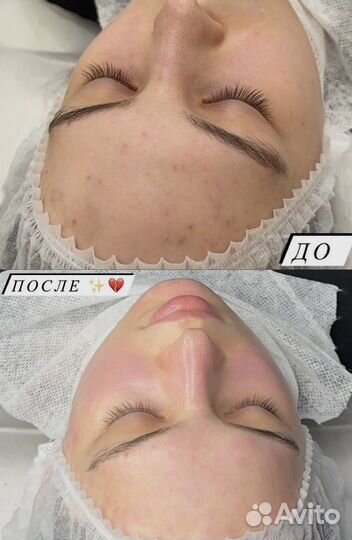 Услуги косметолога