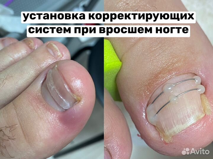 Мастер педикюра, подолог, Люберцы, Жулебино