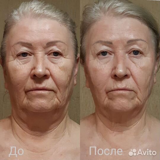 Услуги косметолога-эстетиста