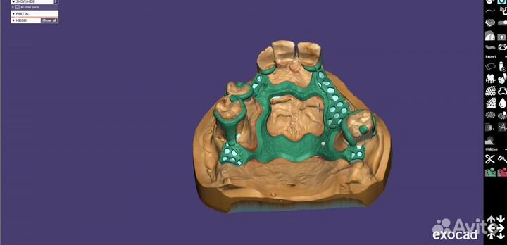 ExoCad 3.1 Rijeka ExoCad 3.0 Galway