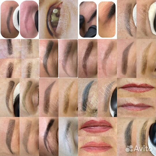 Лазерное удаление татуировок и татуажа Пирсинг