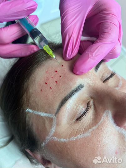 Курсы инъекционной косметологии