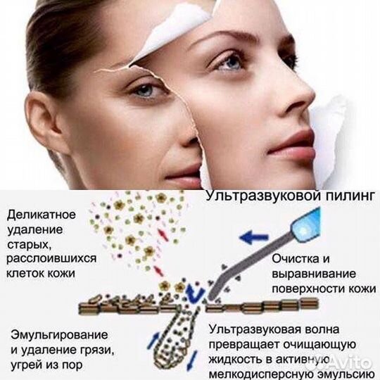 Ультразвуковая чистка лица