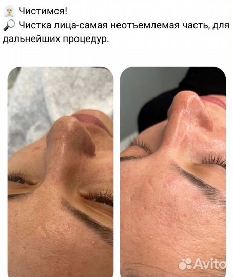 Услуги косметолога