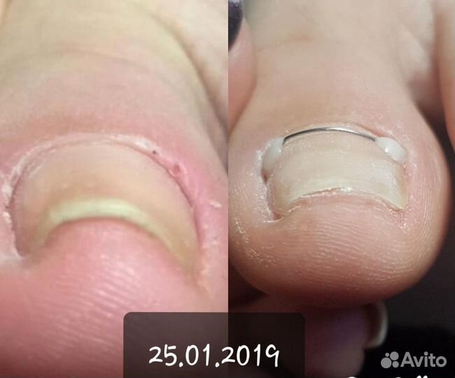 Маникюр,педикюр,оформление бровей