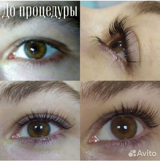 Подологический педикюр