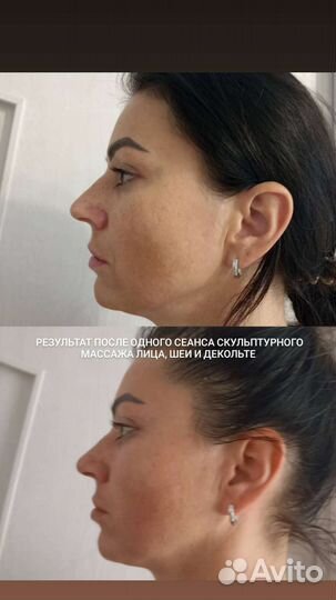 Массаж / кавитация / липосакция / массаж лица