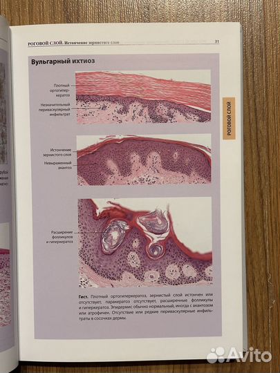 Атлас дерматопатологии Бург Кемпф Куцнер