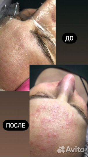 Услуги косметолога