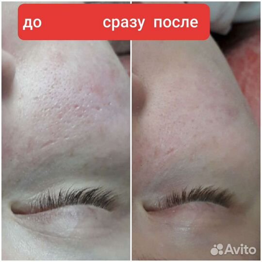 Услуги