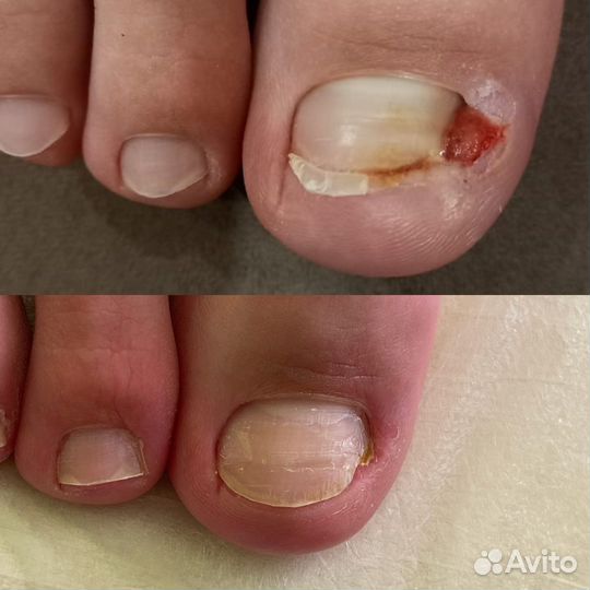 Педикюр подологический (мужской, женский)