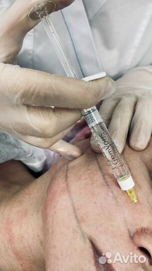 Модель на косметологические процедуры