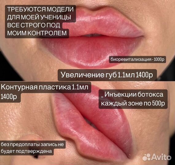 Косметология модели