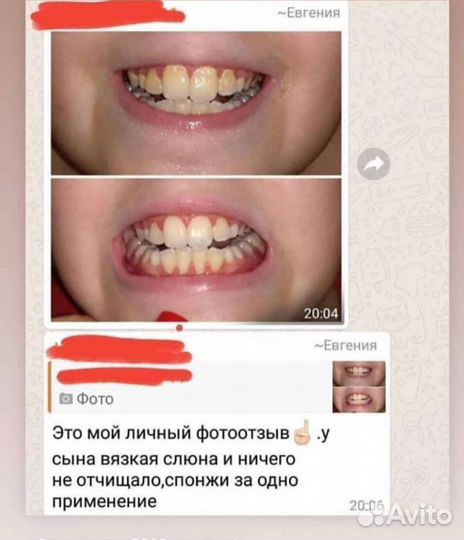 Спонжи для чистки зубов