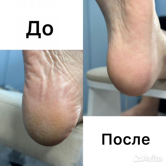 Маникюр/ Педикюр