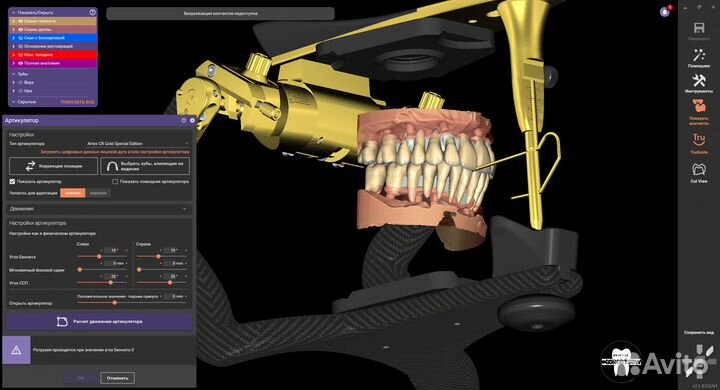 Exocad 3.1 полный комплект+бюгеля