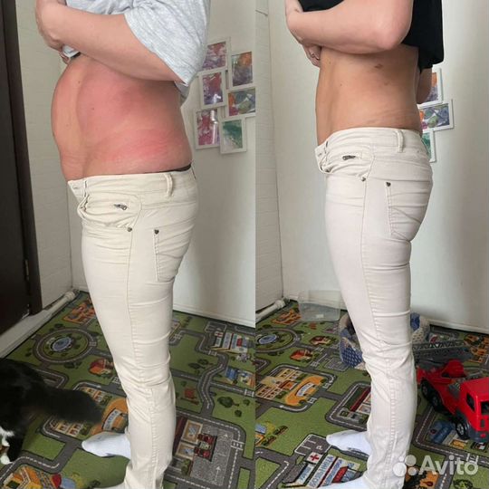 Аппаратный массаж.Похудеть за 16 дней