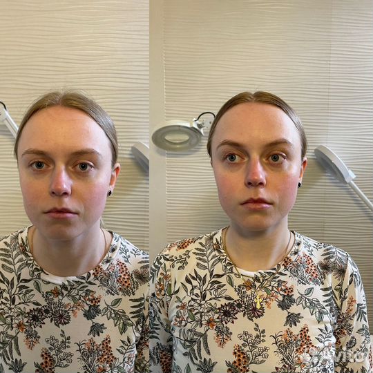 Массаж лица. Скульптурно-букальный,глубокотканный