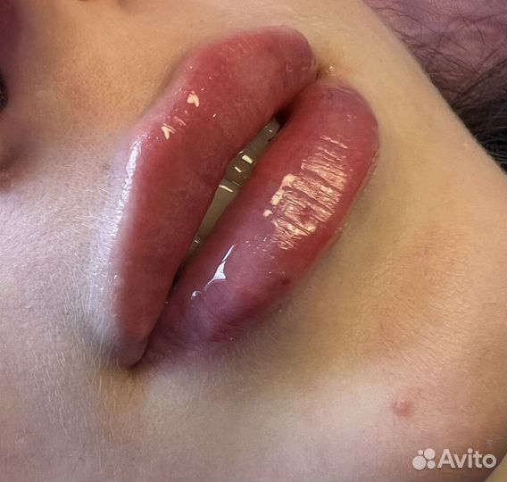 Услуги Косметолога