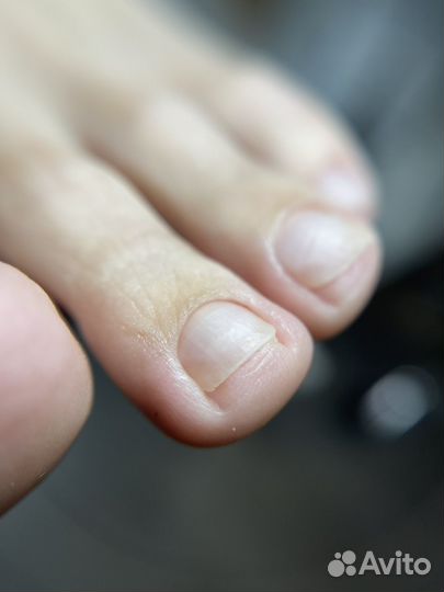 Аппаратный/комбинированный педикюр