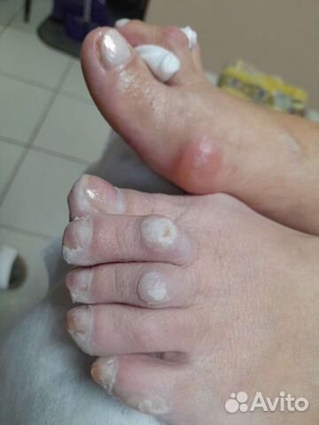 Педикюр любой сложности