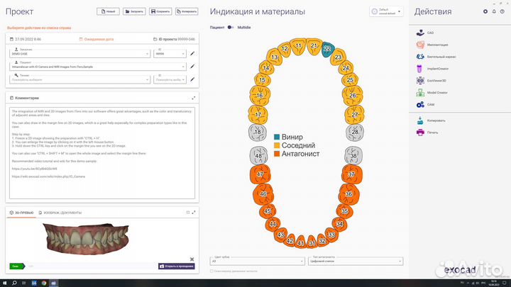 Exocad 3.1RijekaExoplan3.13Shape 2023RealGuide 5.3