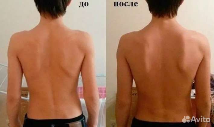 Мануальный массаж(Костоправ)