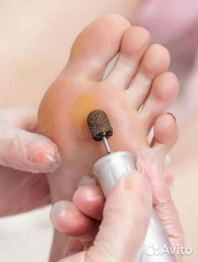 Педикюр(подология)