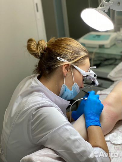 Электроэпиляция