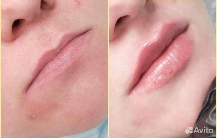 Услуги косметолога