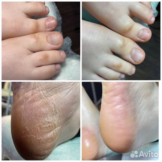 Педикюр, Маникюр, классический, аппаратный