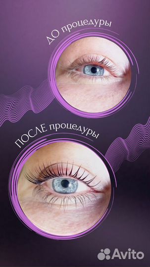 Ламинирование и ботокс ресниц