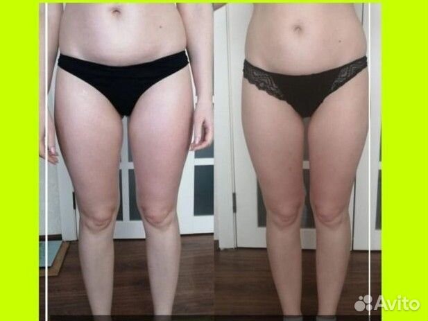 Массаж лица и тела Коррекция фигуры