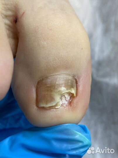 Подолог самара