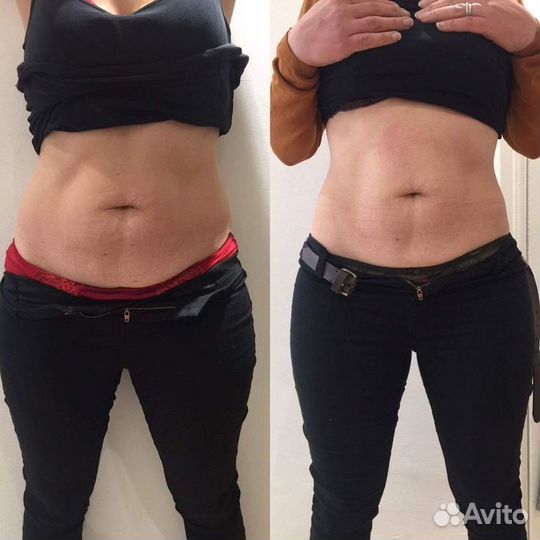 EMS zero Жиротоп+ Прокачка мышц