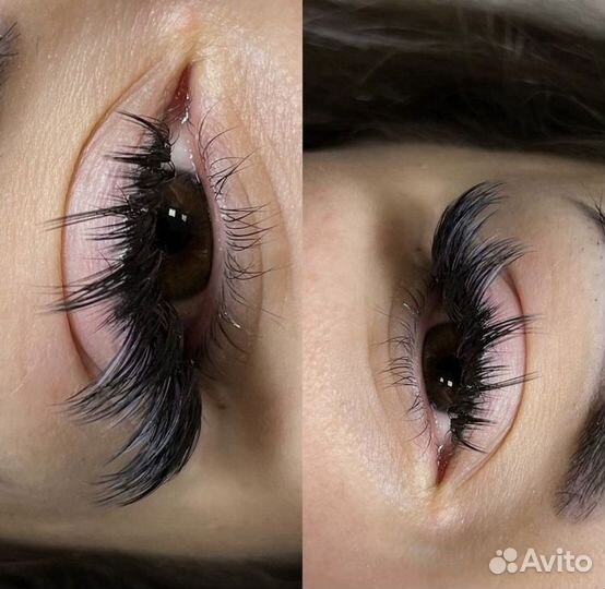 Американское наращивание