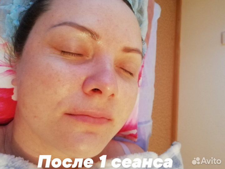Моделирующий массаж лица 5 в 1