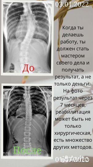 Массажист Костоправ Реабилитолог