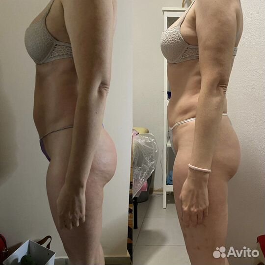 Массаж, коррекция фигуры, активное похудение