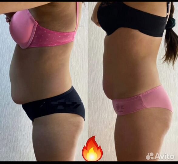 Аппаратный массаж,коррекция фигуры