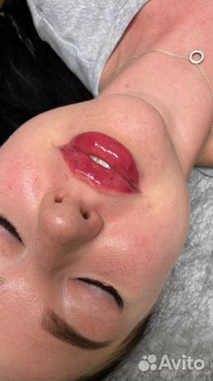 Косметолог. Челюстно-лицевой хирург. Ботокс