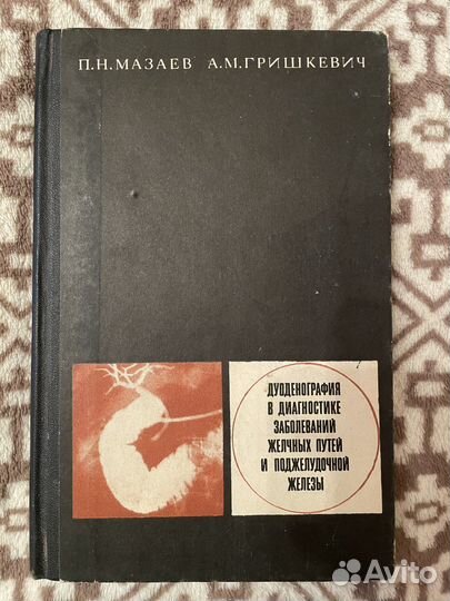 Дуоденография в диагностике заболеваний